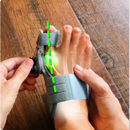 OrthoZen™ – Correcteur Hallux Confort